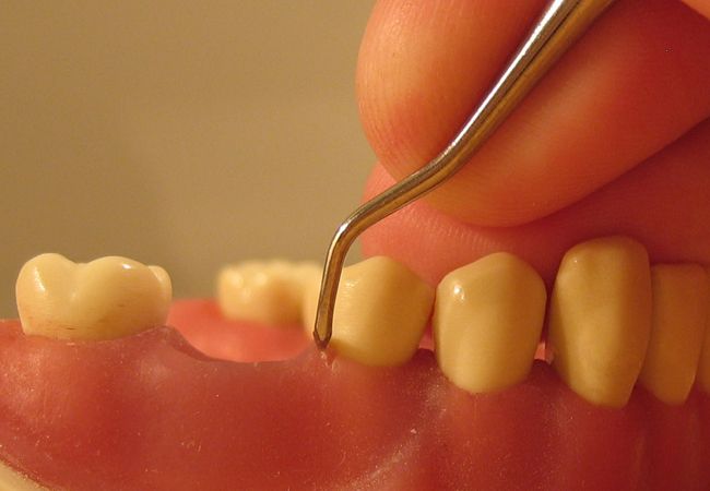 Periodoncia: Especialidades de Clínica Dental Virgen de la Victoria. Dr. Leopoldo Hernández Periodoncia: Especialidades de Clínica Dental Virgen de la Victoria. Dr. Leopoldo Hernández