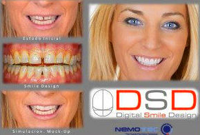 Digital Smile Design Digital Smile Design