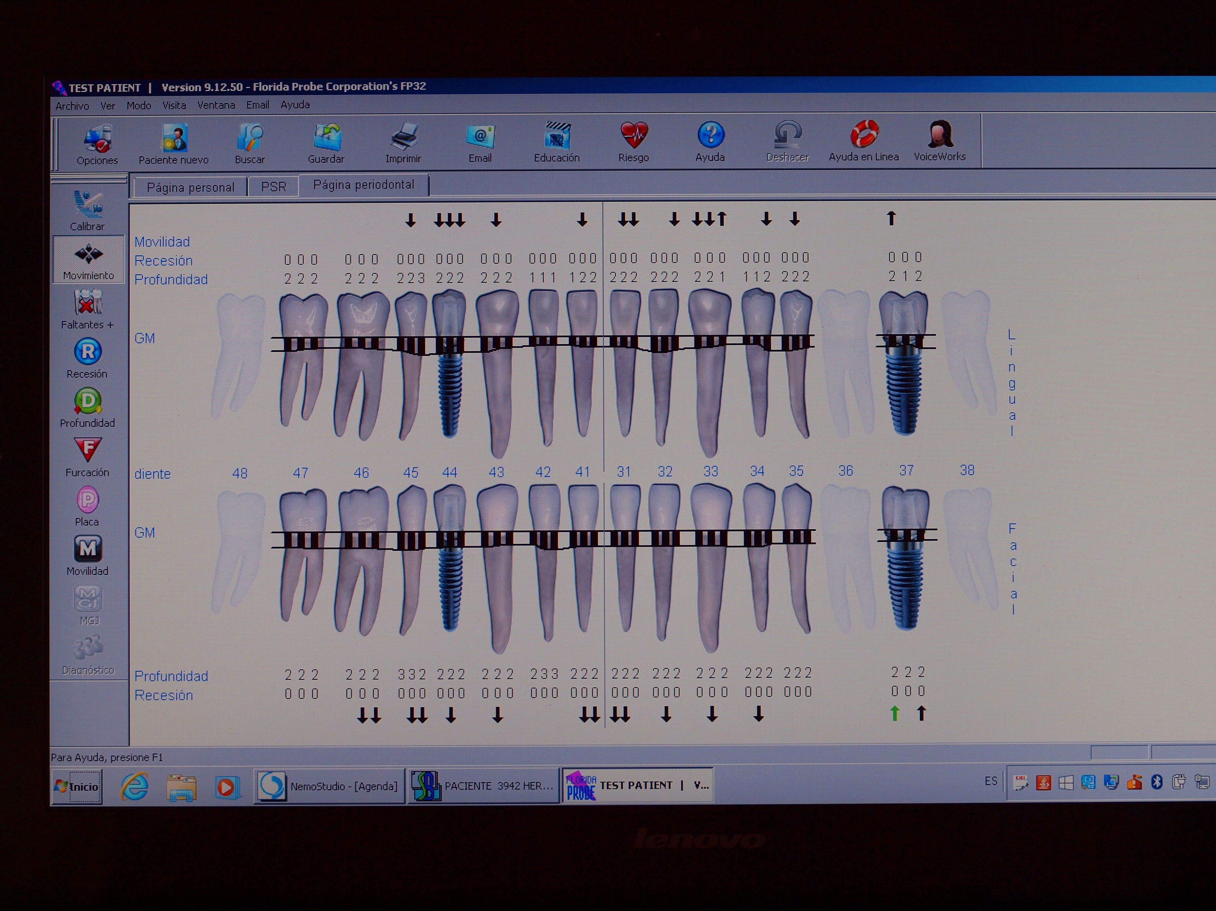 Sonda Florida. Sistema Voi-ceWorks Sonda Florida. Sistema Voi-ceWorks