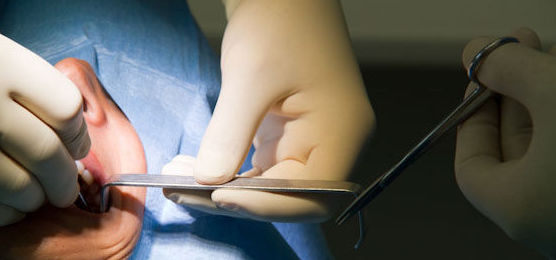 Endodoncia: Tratamientos de IOIB Endodoncia: Tratamientos de IOIB