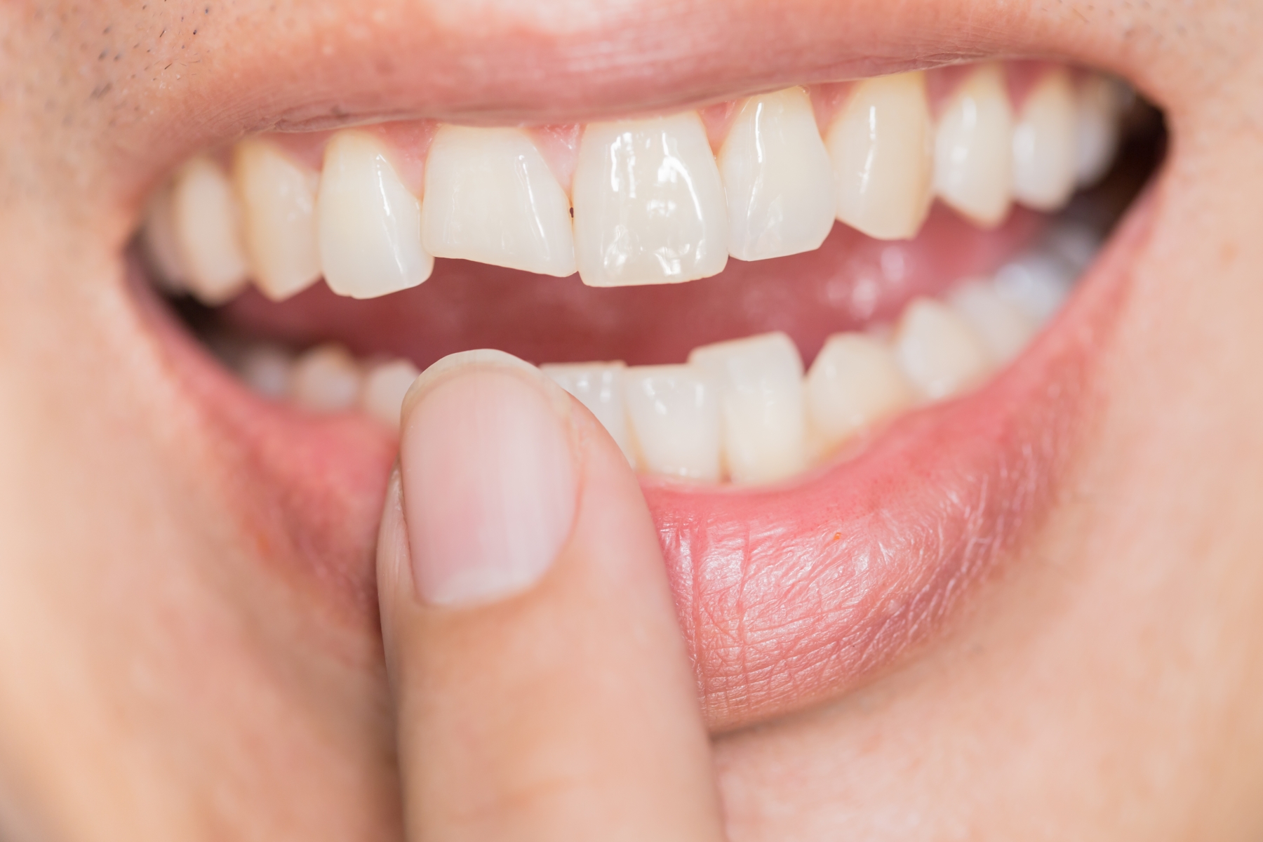 Diseño de sonrisa digital: Especialidades de Clínica Dental Dr. Bassanini Diseño de sonrisa digital: Especialidades de Clínica Dental Dr. Bassanini