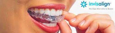 Ortodoncia invisible Invisalign: Tratamientos de Clínica dental Neardental }}