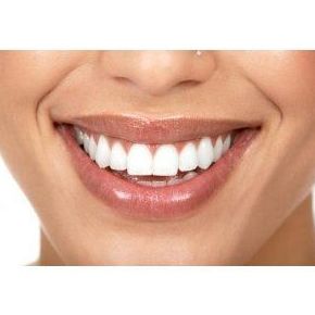 Estética: Tratamientos de Perioim Estética: Tratamientos de Perioim