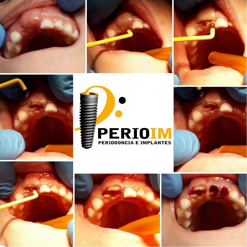 Dentista Torrejón de la Calzada Dentista Torrejón de la Calzada