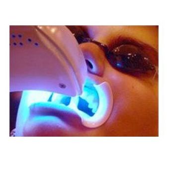 Blanqueamiento: Tratamientos de Perioim Blanqueamiento: Tratamientos de Perioim