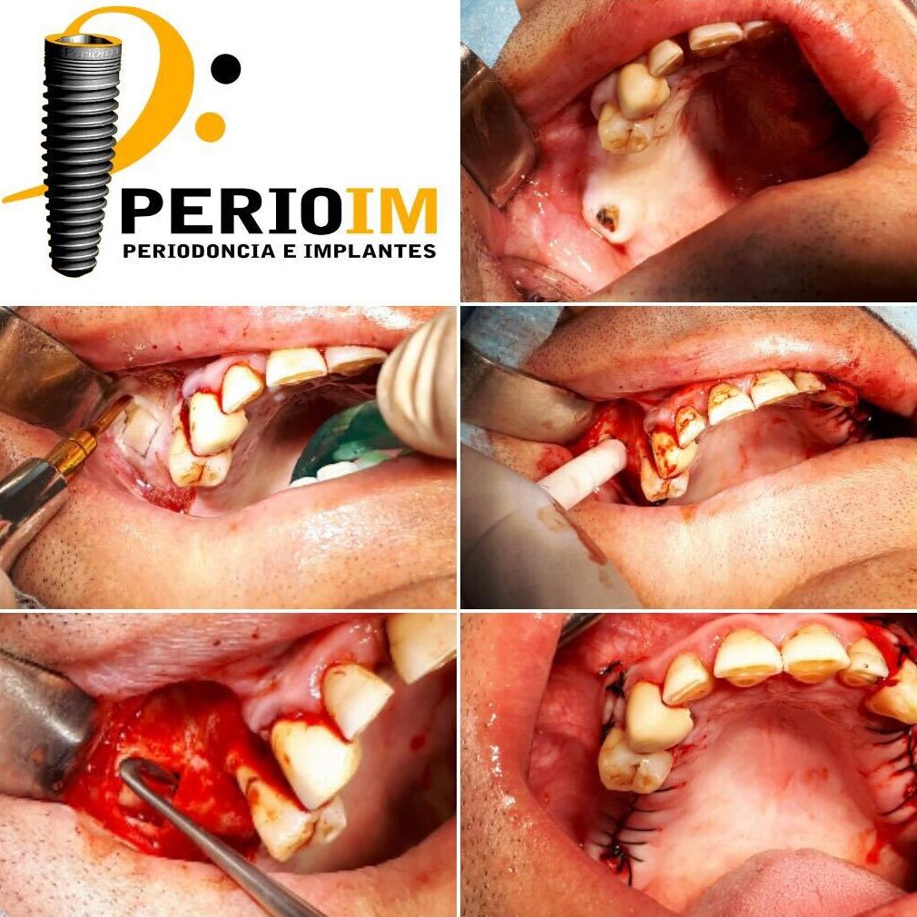 Clínica dental Torrejón de la Calzada Clínica dental Torrejón de la Calzada