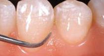 Periodoncia: Servicios odontológicos de Clínica Dental Erniobea Periodoncia: Servicios odontológicos de Clínica Dental Erniobea