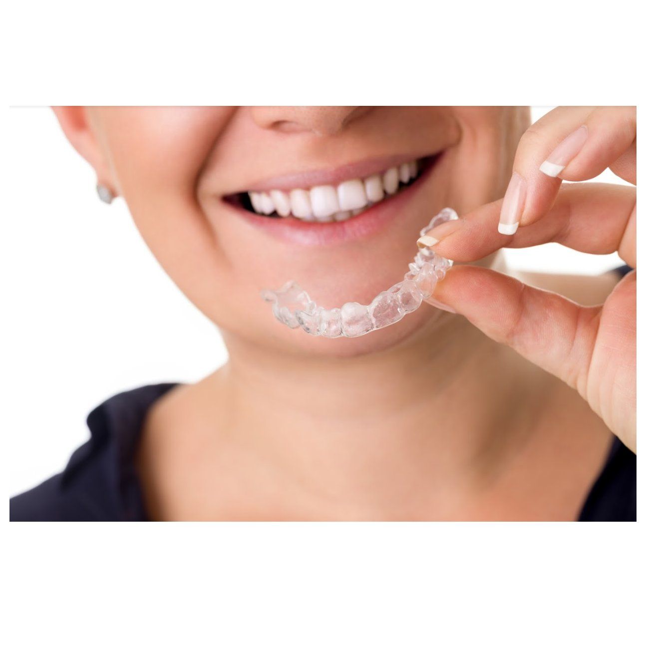 Férula dental Férula dental