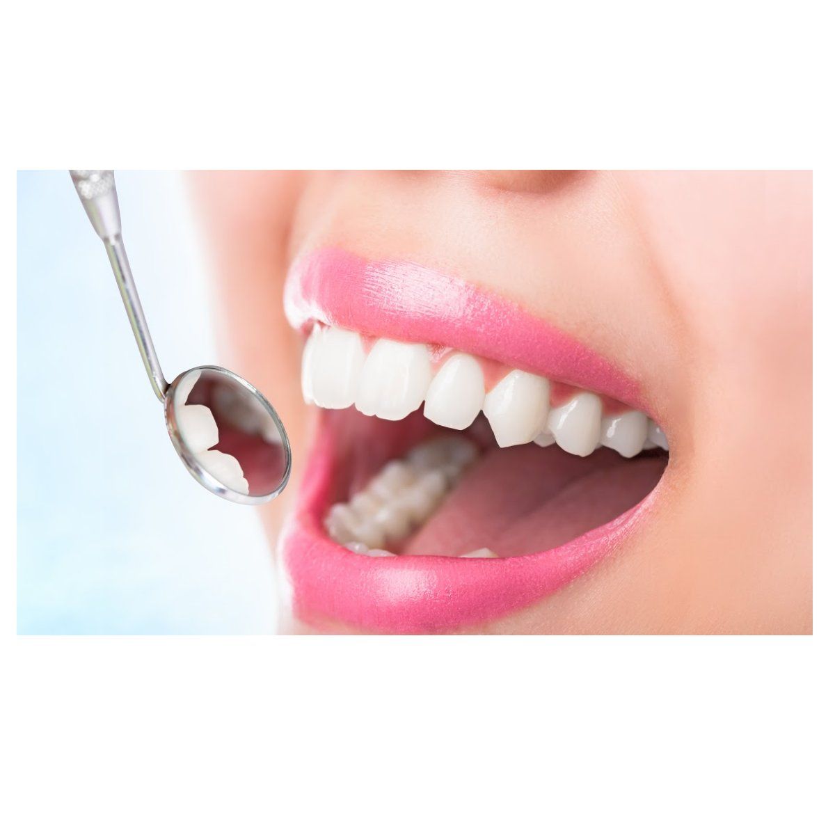 Estética dental Estética dental