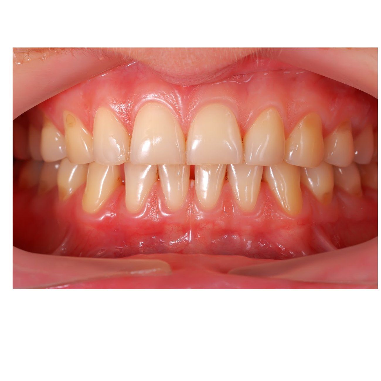 Periodoncia Periodoncia
