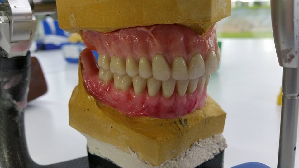 Prótesis removible acrílica: Laboratorio Dental de Laboratorio de Prótesis Dental Prótesis removible acrílica: Laboratorio Dental de Laboratorio de Prótesis Dental