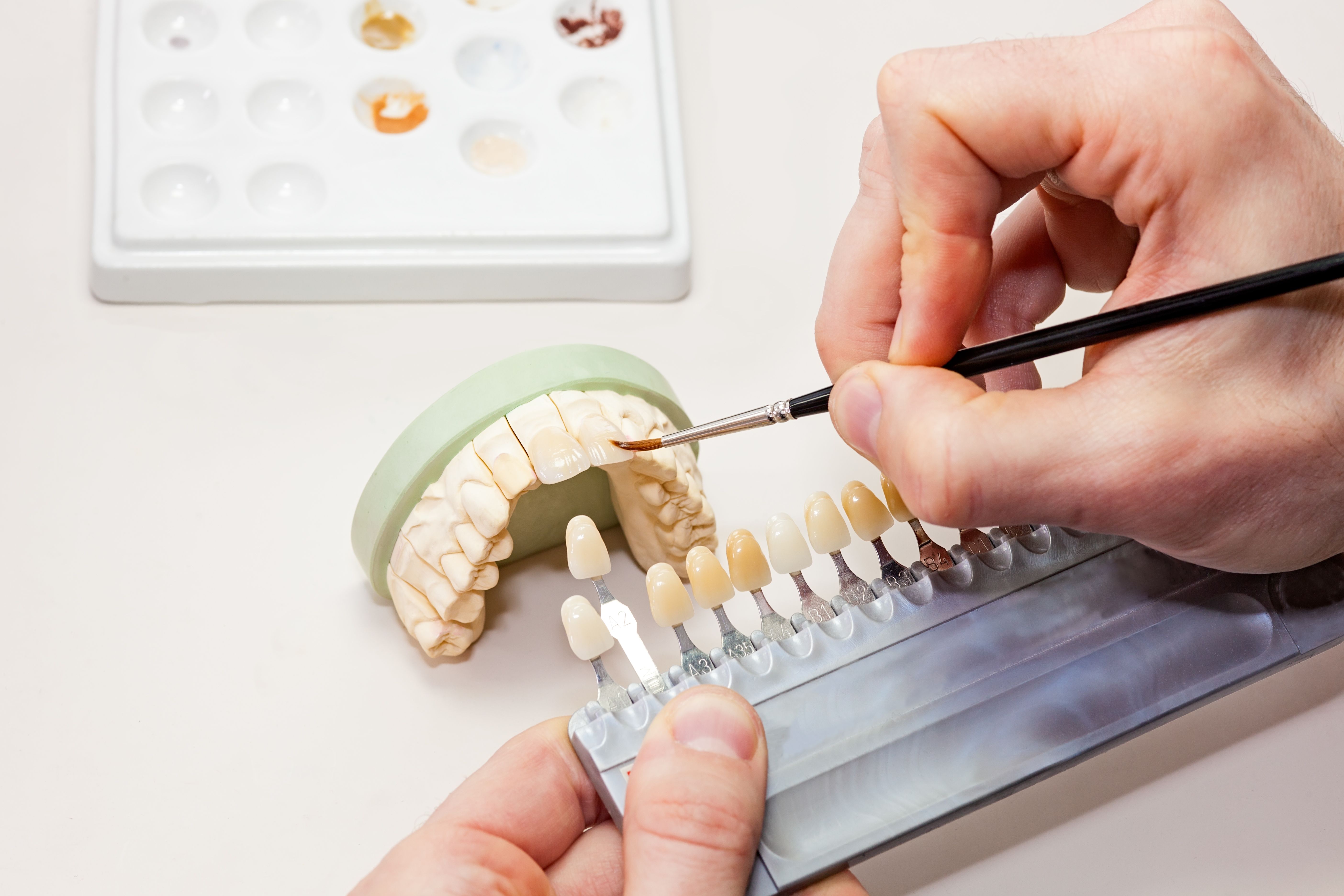 Prótesis fijas de circonio: Laboratorio Dental de Laboratorio de Prótesis Dental Prótesis fijas de circonio: Laboratorio Dental de Laboratorio de Prótesis Dental