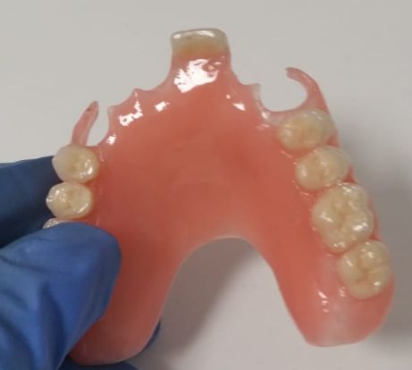 Prótesis removible semiflexible: Laboratorio Dental de Laboratorio de Prótesis Dental Prótesis removible semiflexible: Laboratorio Dental de Laboratorio de Prótesis Dental