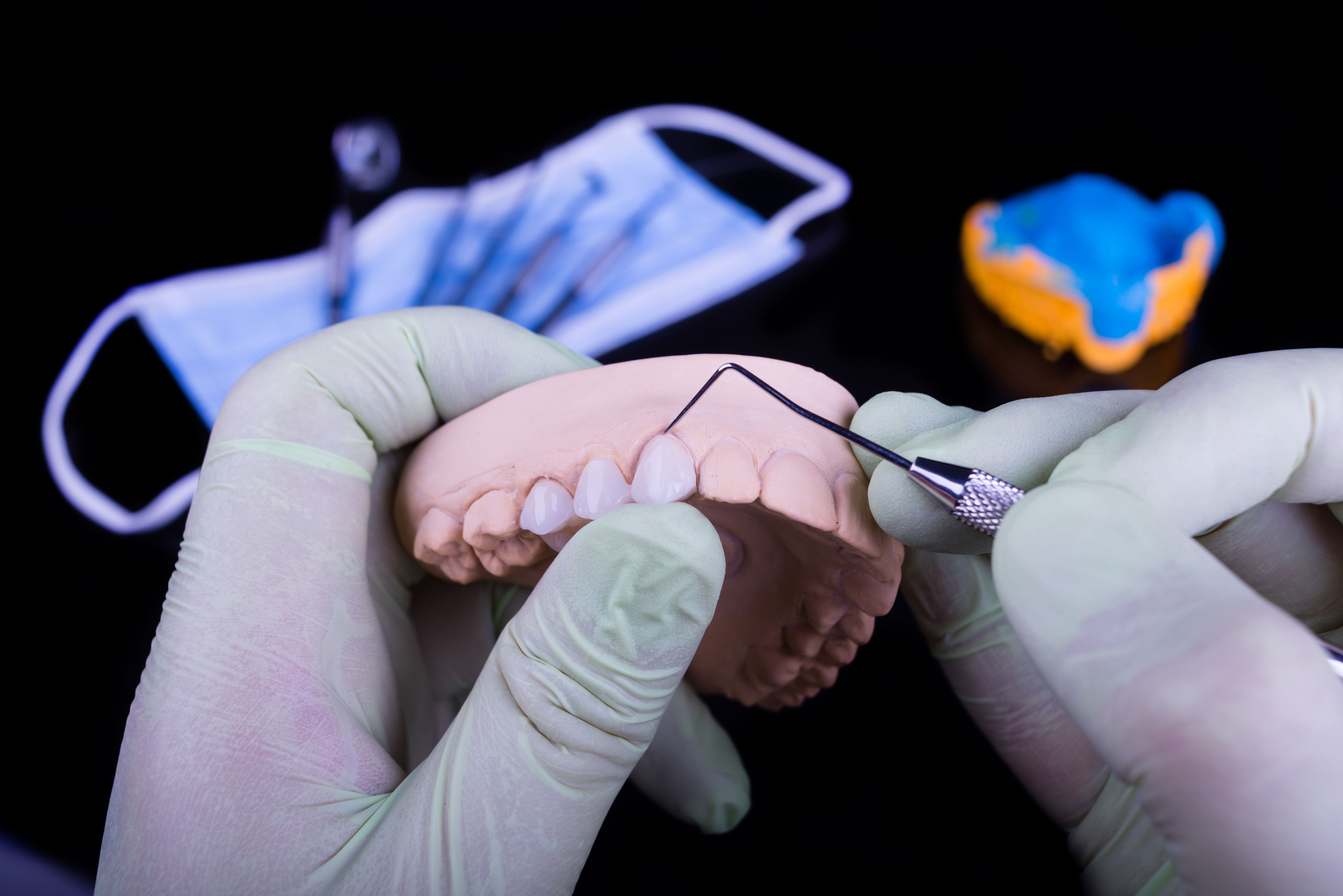 Prótesis fijas de cerámica pura: Laboratorio Dental de Laboratorio de Prótesis Dental Prótesis fijas de cerámica pura: Laboratorio Dental de Laboratorio de Prótesis Dental