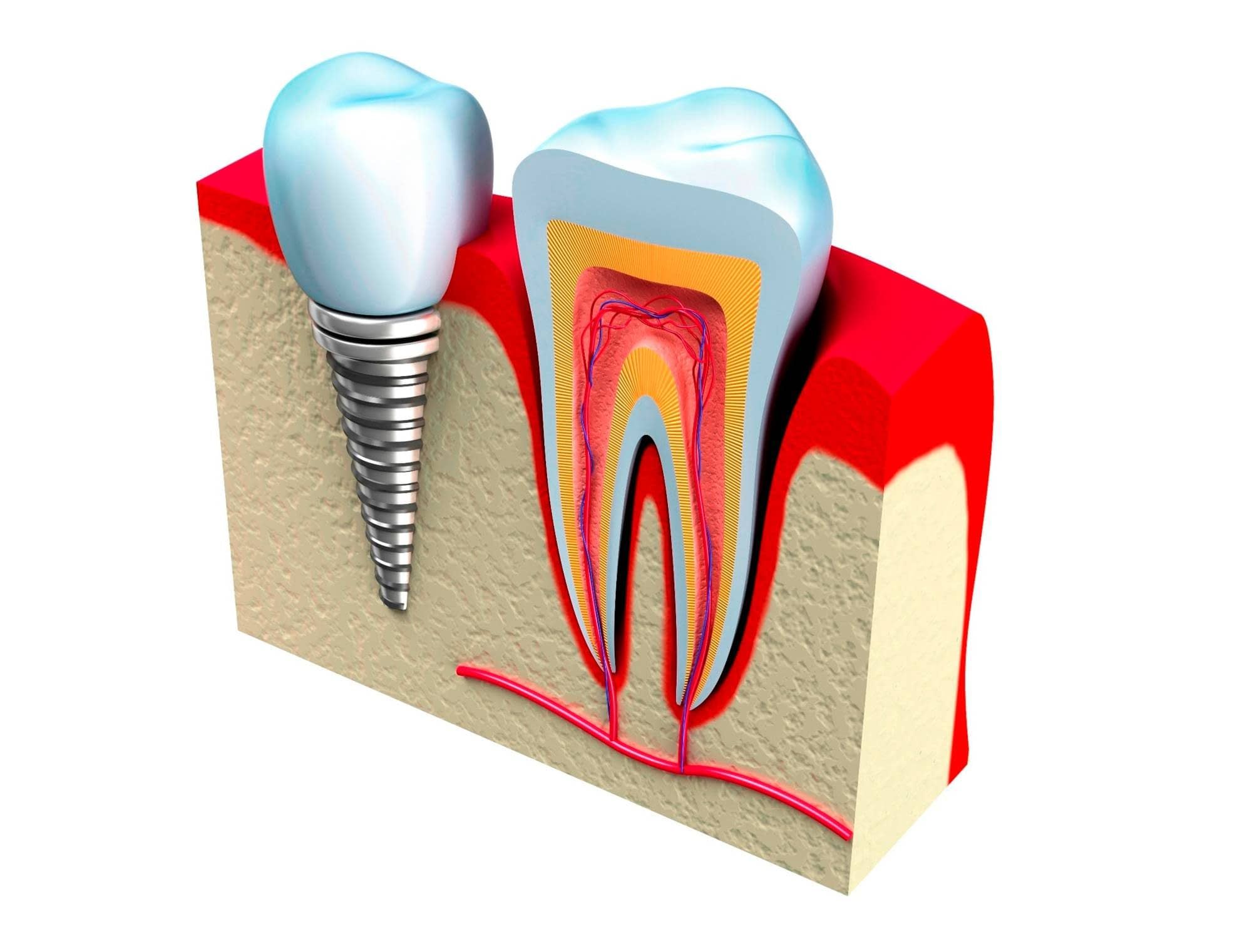 Cirugía y periodoncia: Odontología de Clínica Dental Alai - Zumarraga Cirugía y periodoncia: Odontología de Clínica Dental Alai - Zumarraga
