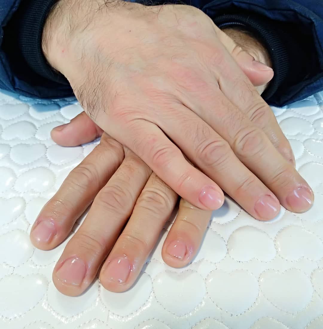 Tratamiento para uñas mordidas: Servicios de Trendy Nails Tratamiento para uñas mordidas: Servicios de Trendy Nails