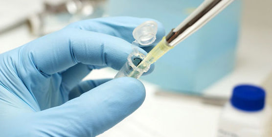 ANÁLISIS GENÉTICO PARA DETECCIÓN DE HONGOS EN UÑAS: Ofrecemos de Laboratorios Ruiz-Falcó ANÁLISIS GENÉTICO PARA DETECCIÓN DE HONGOS EN UÑAS: Ofrecemos de Laboratorios Ruiz-Falcó