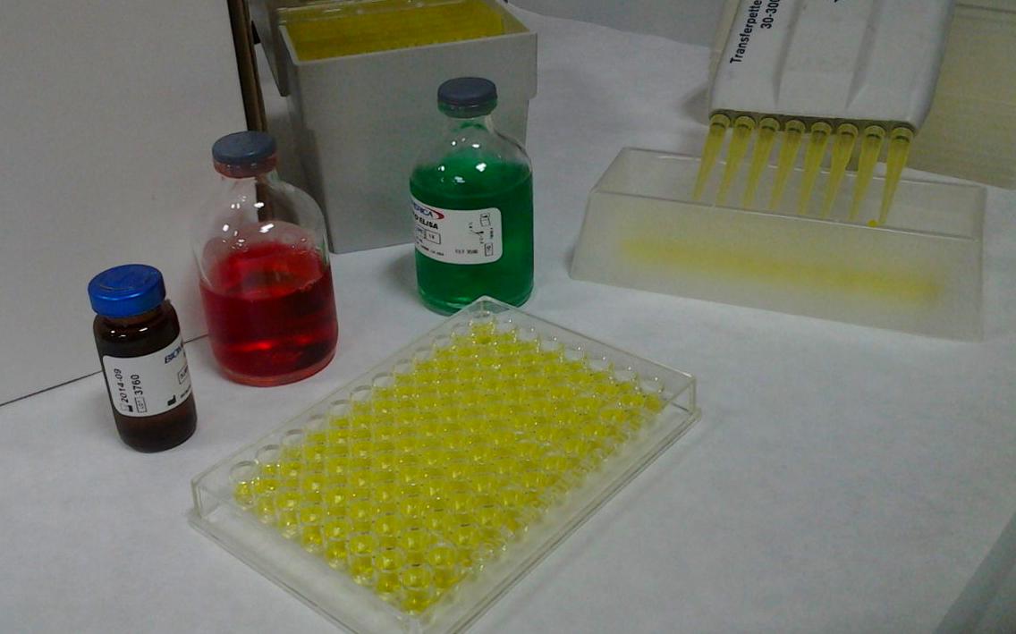 TEST BASICO SENSIBILIDAD ALIMENTARIA: Ofrecemos de Laboratorios Ruiz-Falcó TEST BASICO SENSIBILIDAD ALIMENTARIA: Ofrecemos de Laboratorios Ruiz-Falcó