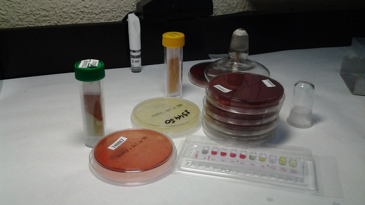 ANALISIS ETS (ENFERMEDAD TRANSMISIÓN SEXUAL): Ofrecemos de Laboratorios Ruiz-Falcó ANALISIS ETS (ENFERMEDAD TRANSMISIÓN SEXUAL): Ofrecemos de Laboratorios Ruiz-Falcó