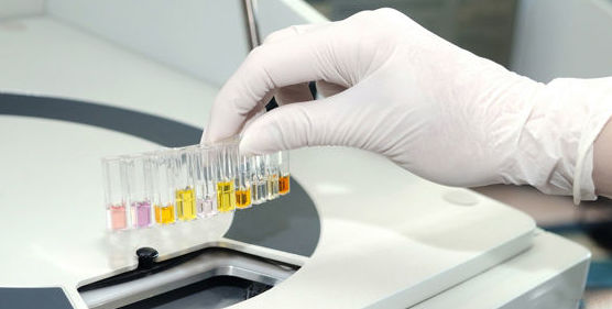 ANALISIS ANTICUERPOS HIV: Ofrecemos de Laboratorios Ruiz-Falcó ANALISIS ANTICUERPOS HIV: Ofrecemos de Laboratorios Ruiz-Falcó