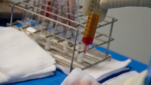 HERPES GENITAL EN MADRID: Ofrecemos de Laboratorios Ruiz-Falcó HERPES GENITAL EN MADRID: Ofrecemos de Laboratorios Ruiz-Falcó