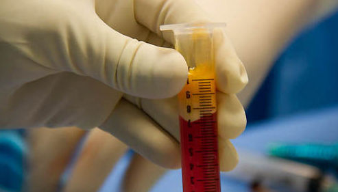 HERPES VIRUS TIPO 2 (GENITAL) ANTICUERPOS: Ofrecemos de Laboratorios Ruiz-Falcó HERPES VIRUS TIPO 2 (GENITAL) ANTICUERPOS: Ofrecemos de Laboratorios Ruiz-Falcó