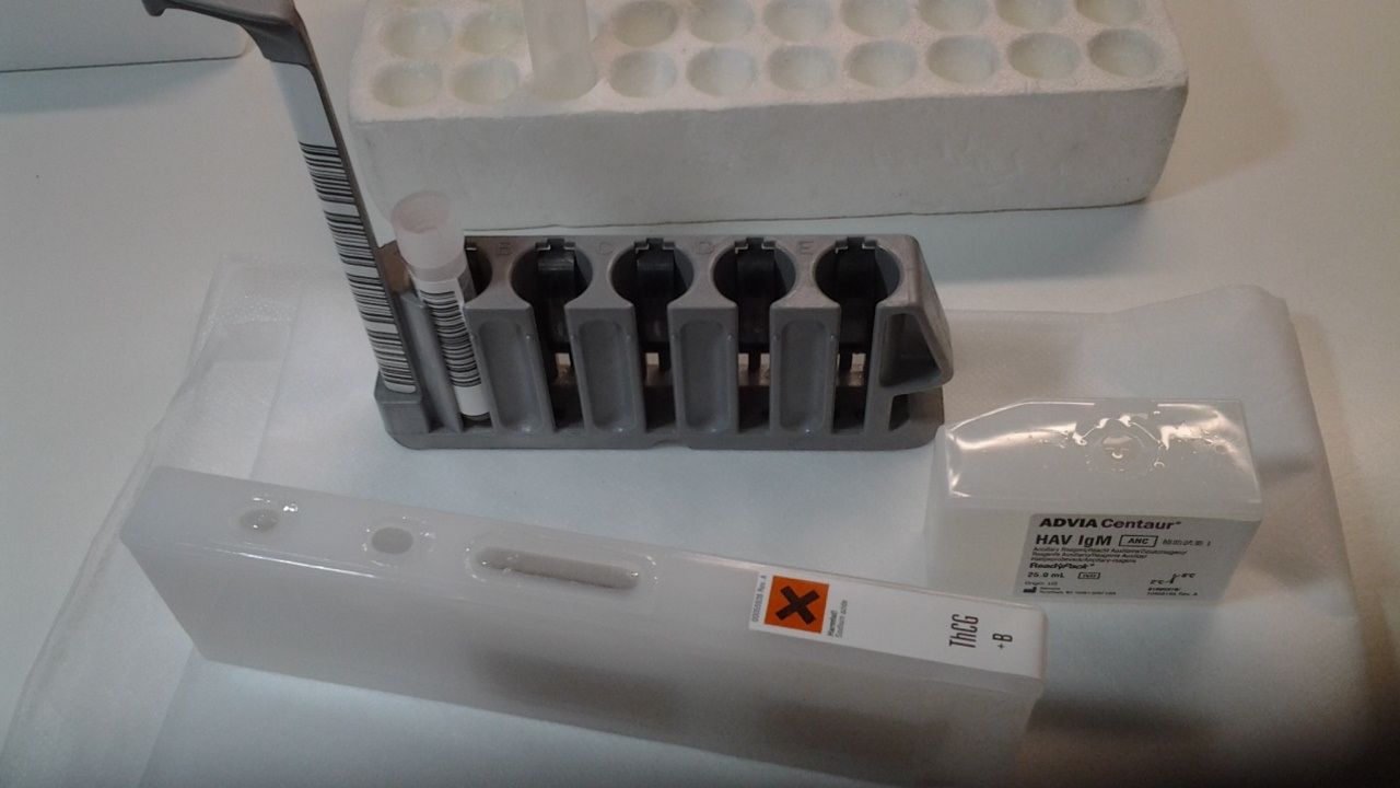 PRUEBA DE EMABARAZO EN SANGRE EN 24 HORAS: Ofrecemos de Laboratorios Ruiz-Falcó PRUEBA DE EMABARAZO EN SANGRE EN 24 HORAS: Ofrecemos de Laboratorios Ruiz-Falcó