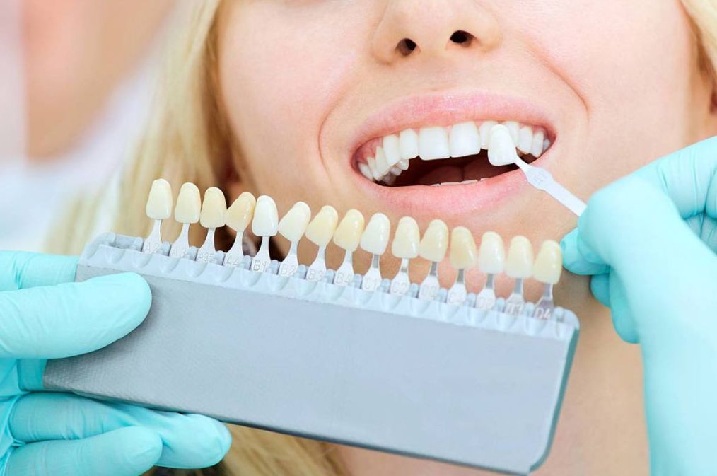 Estética dental: Especialidades de Clínica Dental Dr. Yagüe
