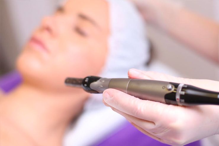 Dermapen: Tratamientos de Equilibra Estética Avanzada Dermapen: Tratamientos de Equilibra Estética Avanzada