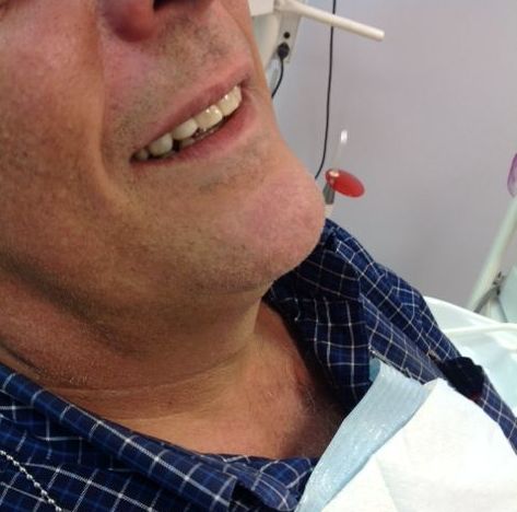 Caso clínico 5. Implantes dentales Madrid