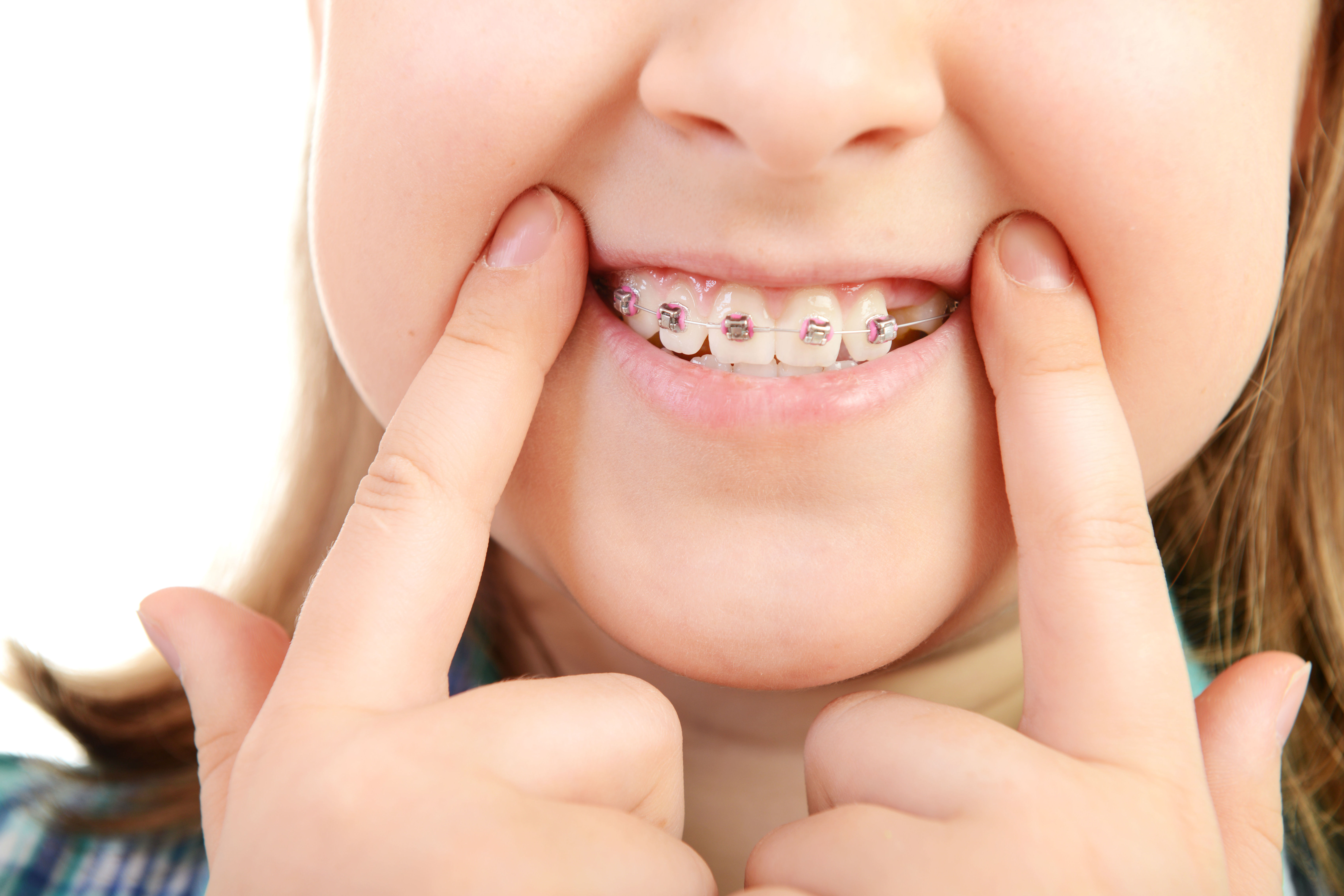 Ortodoncia para niños : Ortodoncia de Isabel Perales Clínica Dental Ortodoncia para niños : Ortodoncia de Isabel Perales Clínica Dental