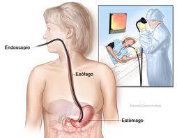 Endoscopia: Tratamientos de Clínica Merello Endoscopia: Tratamientos de Clínica Merello