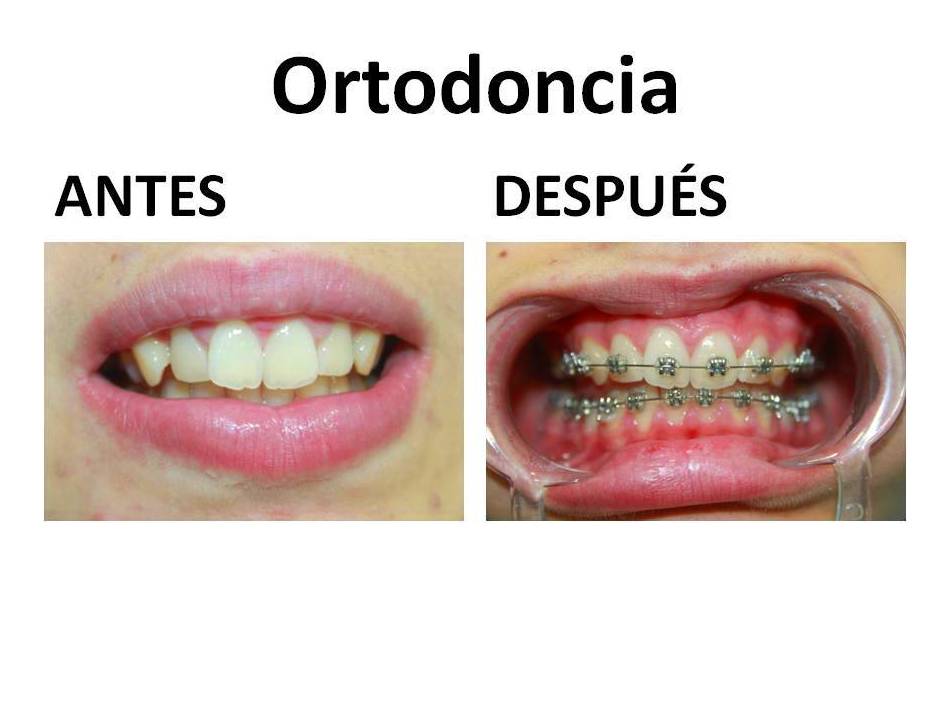 Ortodoncia: Nuestras especialidades de Clínica dental Dr. Vásquez Ortodoncia: Nuestras especialidades de Clínica dental Dr. Vásquez