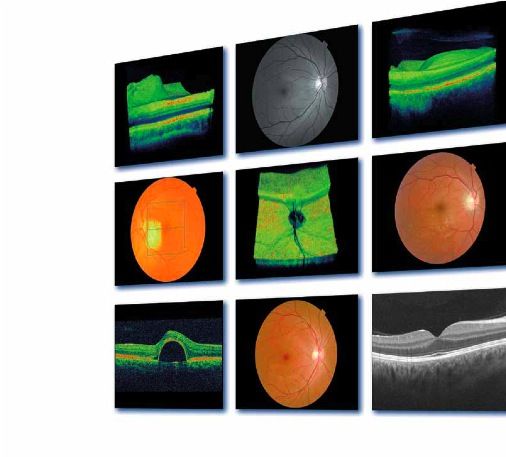 Tomografía de coherencia óptica (OCT): Catálogo de Natural Optics Vermas Tomografía de coherencia óptica (OCT): Catálogo de Natural Optics Vermas