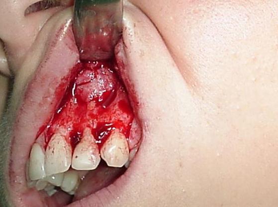 Tratamientos: Especialidades de Modelo-Maxilofacial Tratamientos: Especialidades de Modelo-Maxilofacial