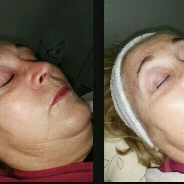 Tratamientos faciales y corporales: Servicios de Erika Estañ Tratamientos faciales y corporales: Servicios de Erika Estañ