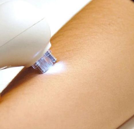 Depilación láser: Servicios de Herbolario Hierbabuena Depilación láser: Servicios de Herbolario Hierbabuena