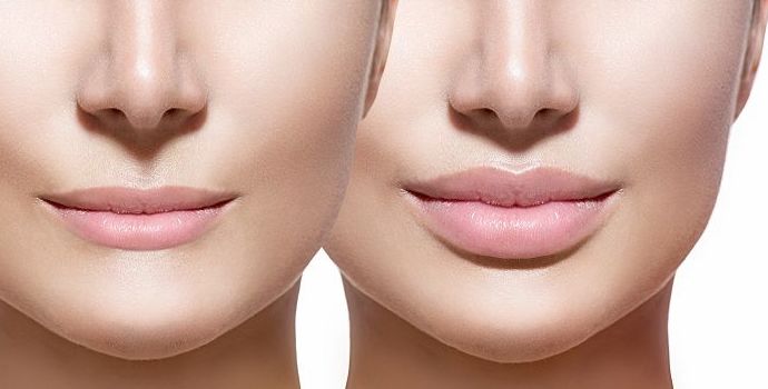 Curso Hyaluron Pen on line: Servicios de Beauty Channel Curso Hyaluron Pen on line: Servicios de Beauty Channel