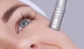 Dermoabrasión: Estética facial: Servicios de C. López Dermoabrasión: Estética facial: Servicios de C. López