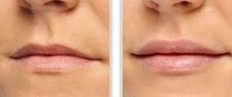 Micropigmentación de Labios: Servicios de C. López Micropigmentación de Labios: Servicios de C. López