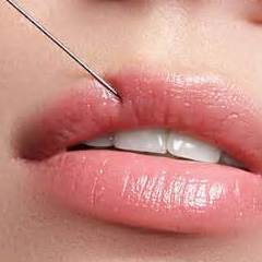Relleno de labios: Servicios de C. López Relleno de labios: Servicios de C. López