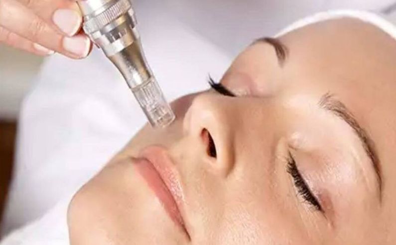 Curso Dermapen: Servicios de C. López Curso Dermapen: Servicios de C. López
