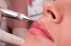 Relleno de labios: Servicios de C. López Relleno de labios: Servicios de C. López
