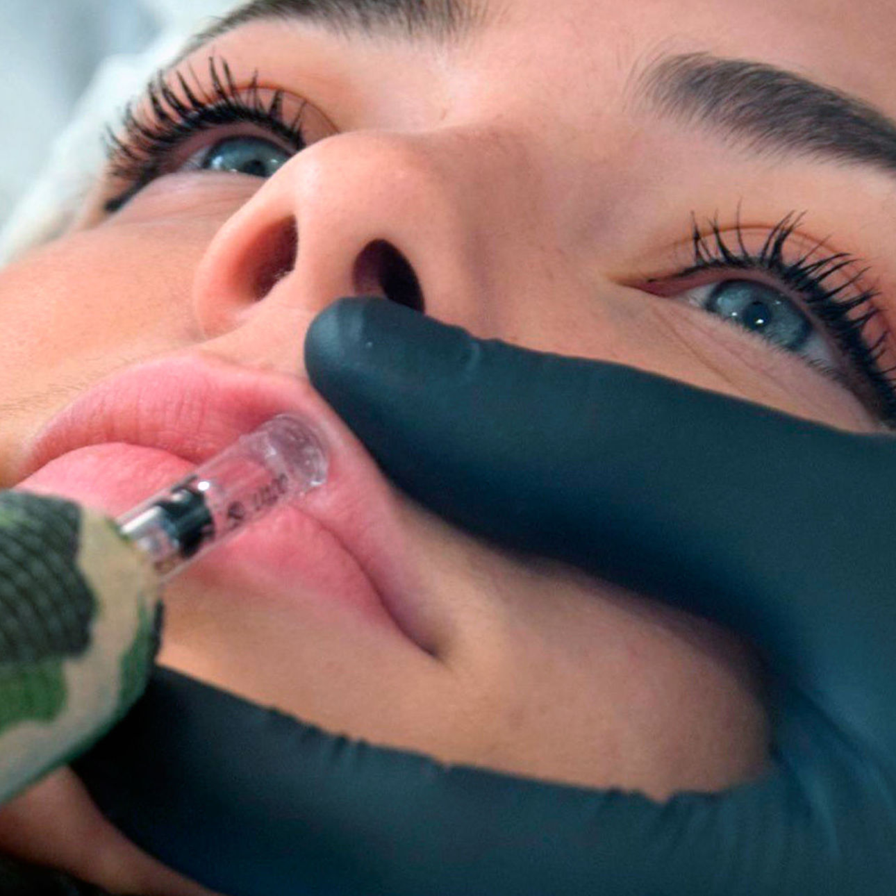 Curso Hyaluron Pen on line: Servicios de Beauty Channel Curso Hyaluron Pen on line: Servicios de Beauty Channel