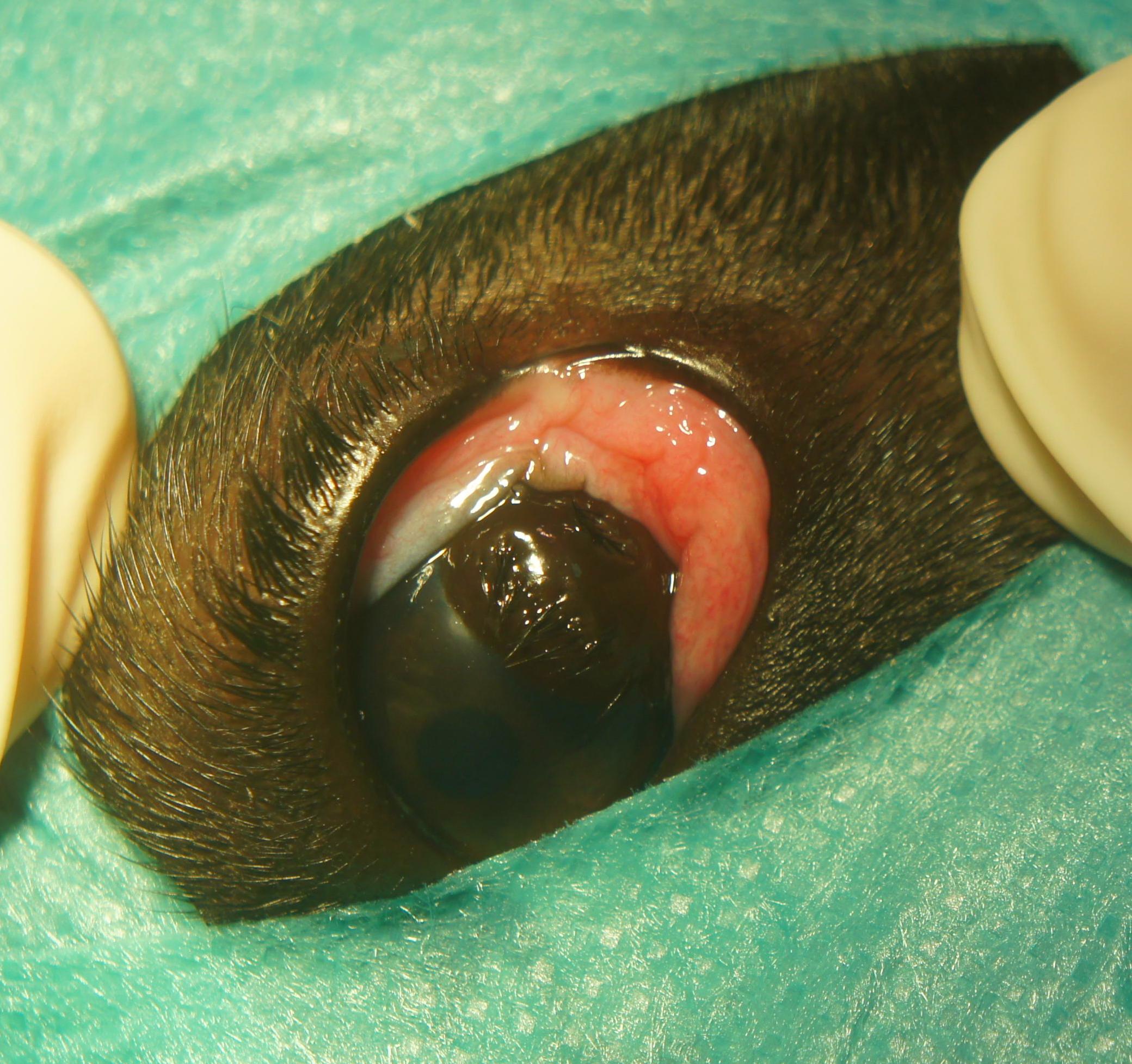 QUISTE DERMOIDE EN CORNEA QUISTE DERMOIDE EN CORNEA