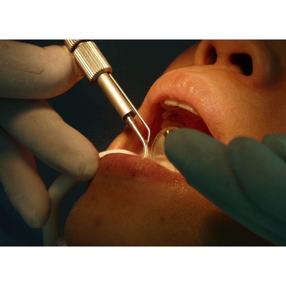 Endodoncia: Especialidades de Clínica San Francisco de Alcalá Endodoncia: Especialidades de Clínica San Francisco de Alcalá