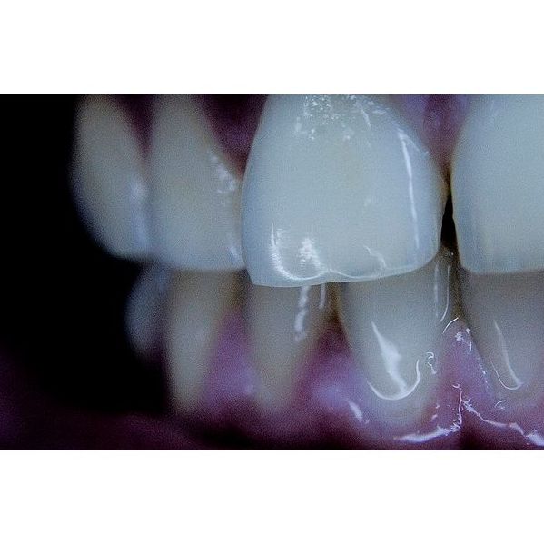 Periodoncia : Especialidades de Clínica San Francisco de Alcalá Periodoncia : Especialidades de Clínica San Francisco de Alcalá