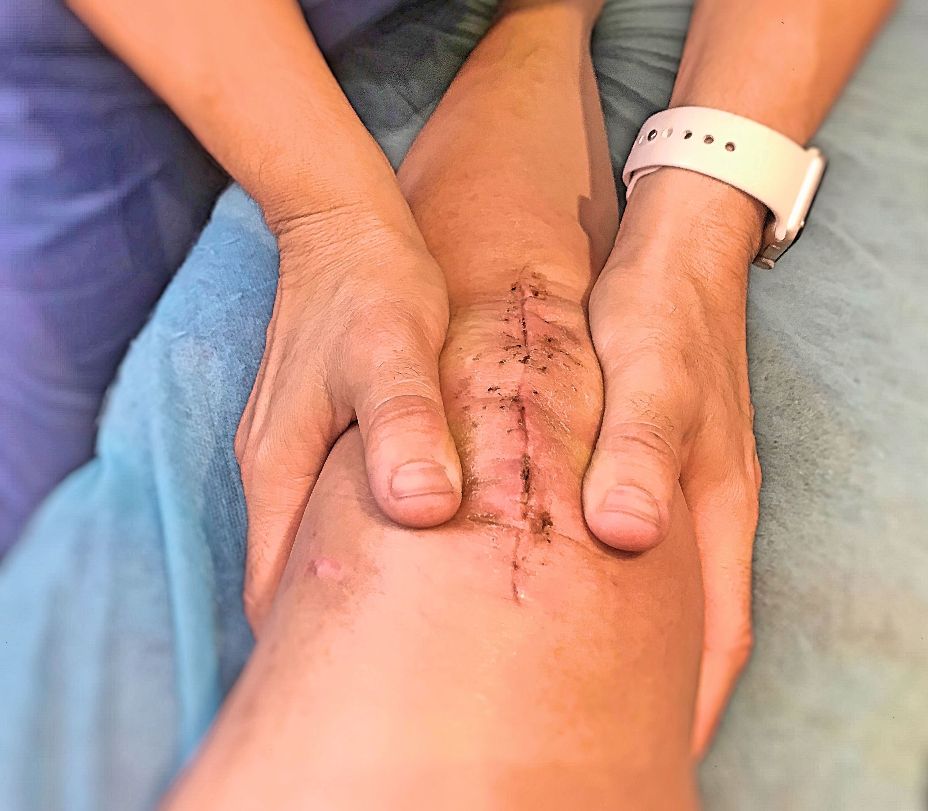 Fisioterapia pre y post quirúrgica: Tratamientos y pedir cita de Optima Fisioterapia Fisioterapia pre y post quirúrgica: Tratamientos y pedir cita de Optima Fisioterapia