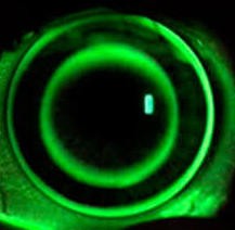 Lentes de contacto gas permeables: CATÁLOGO de CENTRO ÓPTICO VILLASAN Lentes de contacto gas permeables: CATÁLOGO de CENTRO ÓPTICO VILLASAN