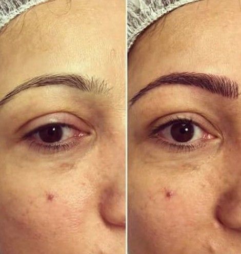 Micropigmentación: Tratamientos de María Ledesma Belleza y Salud Micropigmentación: Tratamientos de María Ledesma Belleza y Salud